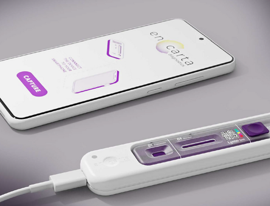 En Carta Diagnostics secures €1.5M in pre-seed funding